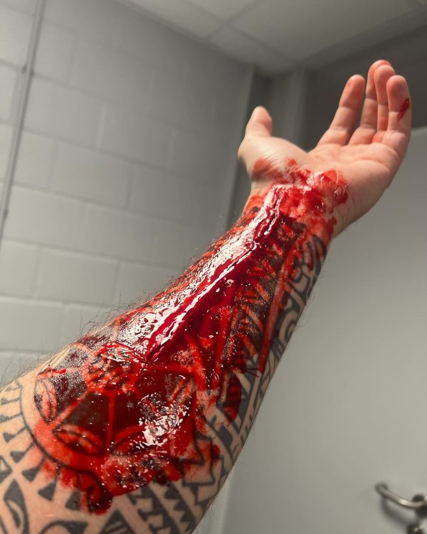 Emergency care for motorcyclists