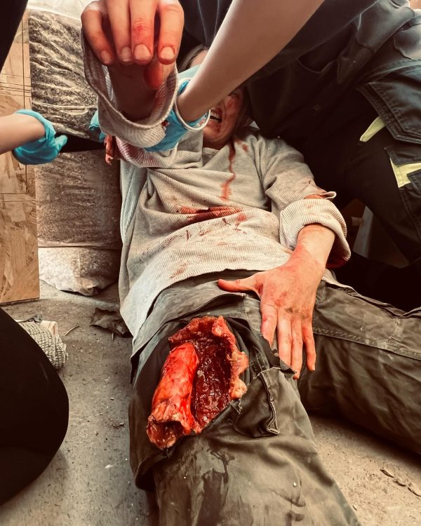 Emergency care for motorcyclists