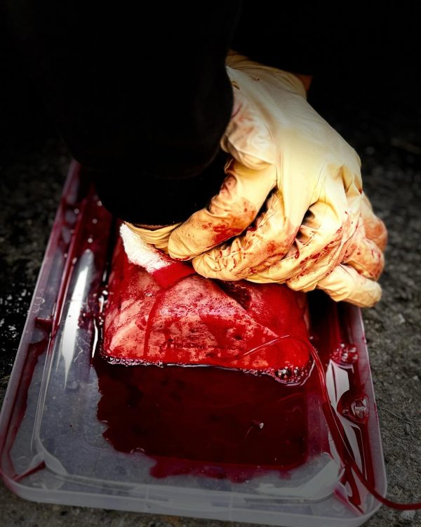 Emergency care for motorcyclists