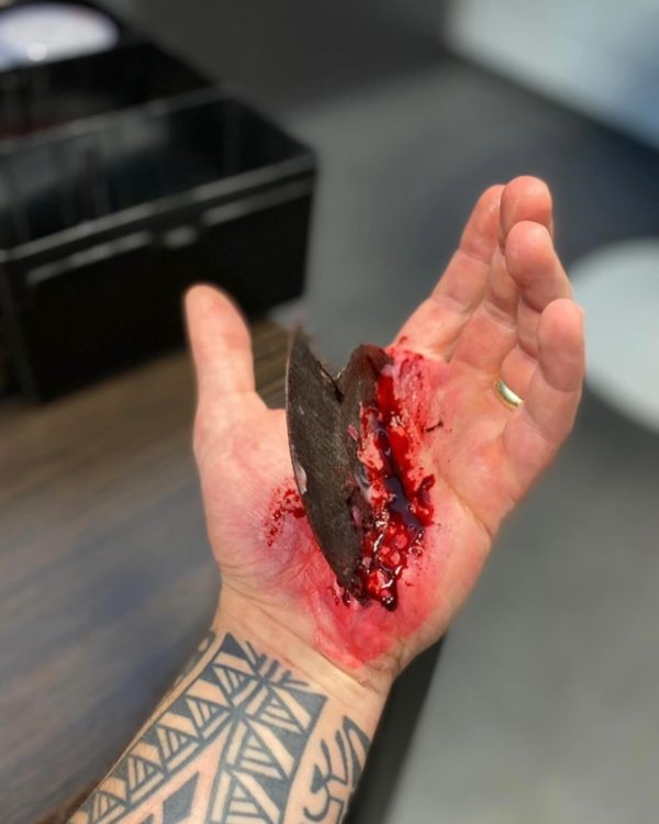 Emergency care for motorcyclists