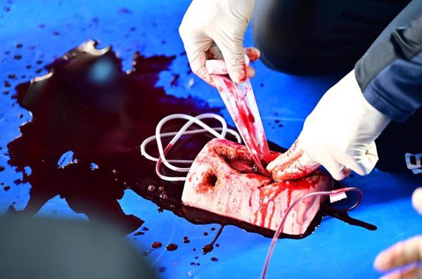 Emergency care for motorcyclists